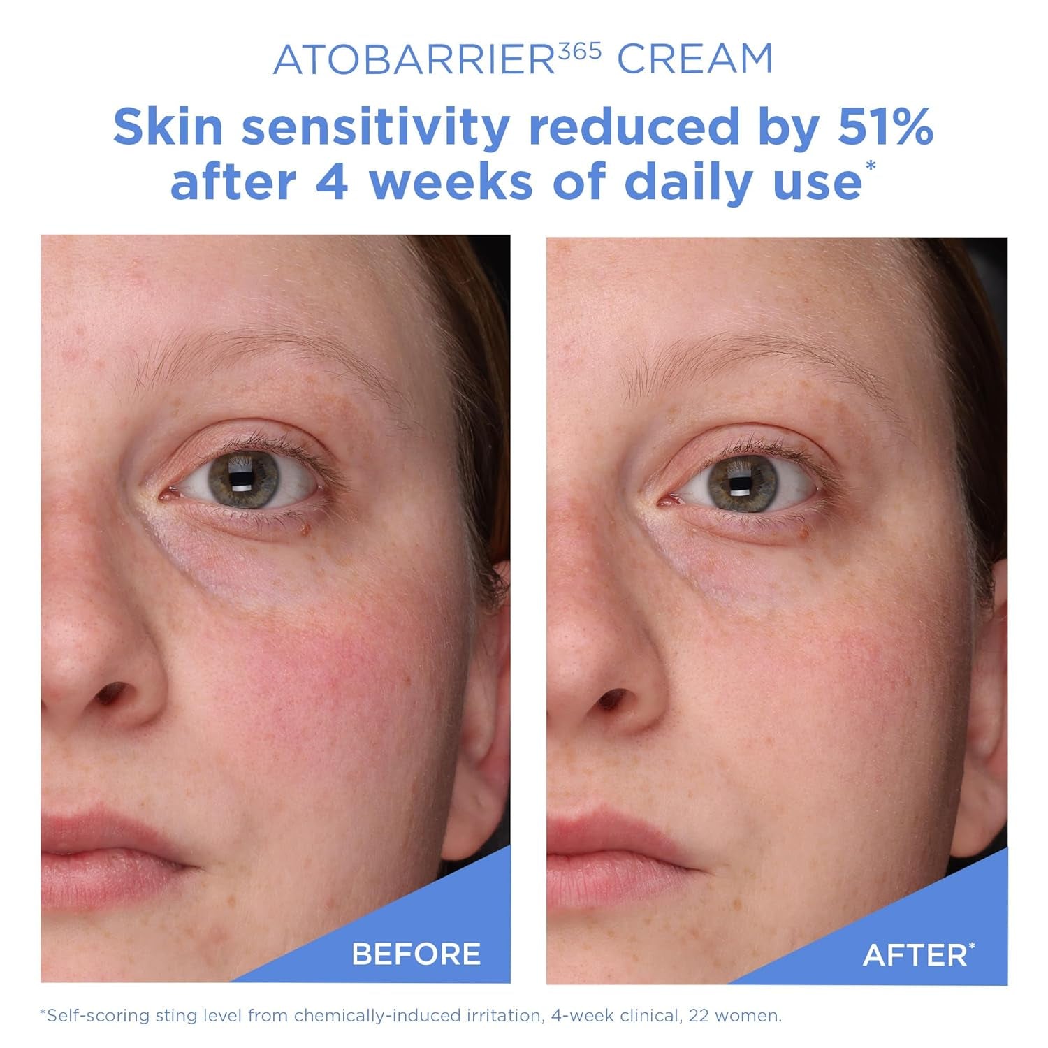 AESTURA ATOBARRIER365 Ceramide Barrier Repair Cream – Deep Hydration Moisturizer for Dry & Sensitive Skin