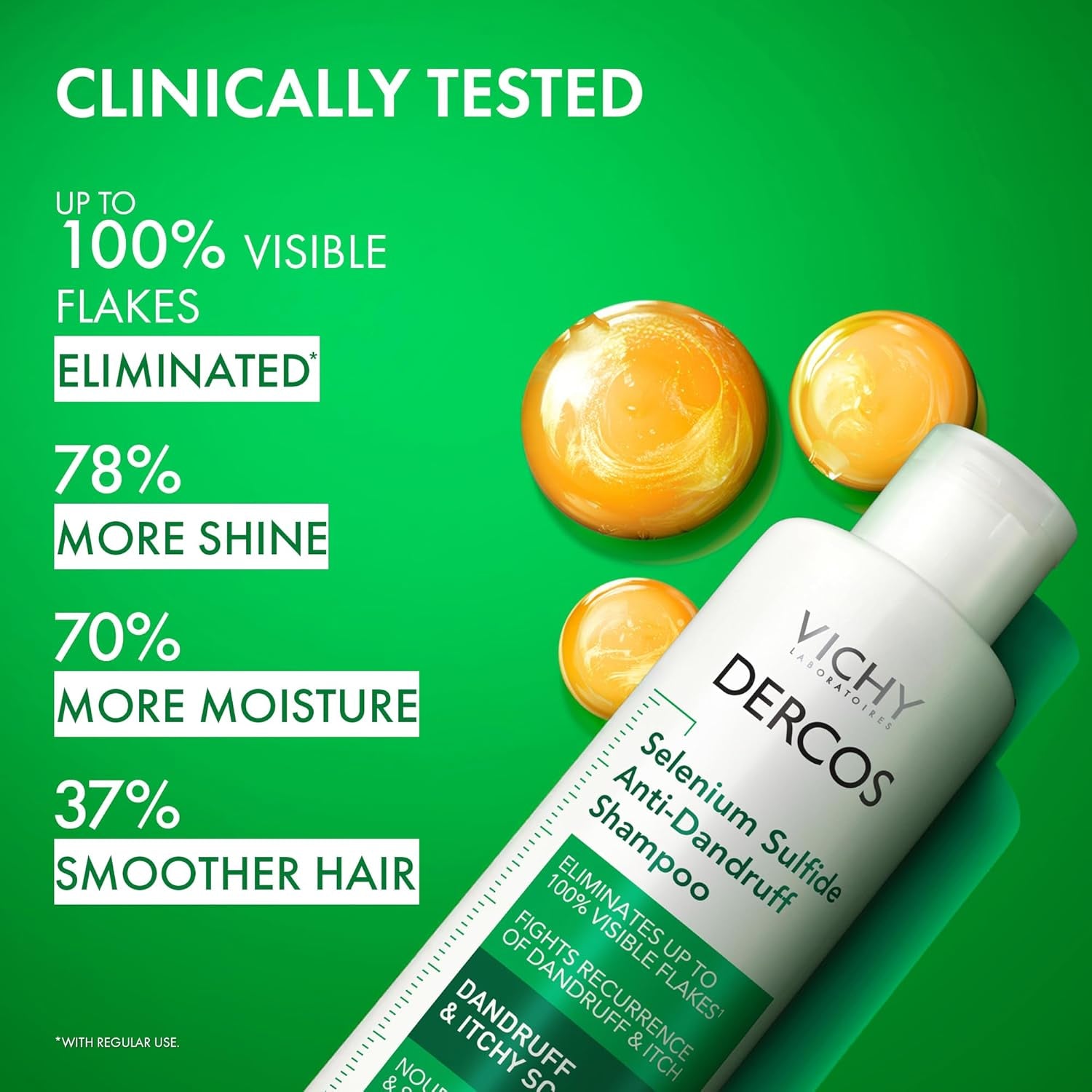 Vichy Dercos Anti-Dandruff Shampoo – Selenium Sulfide Dry Scalp Relief & Flake Control Treatment