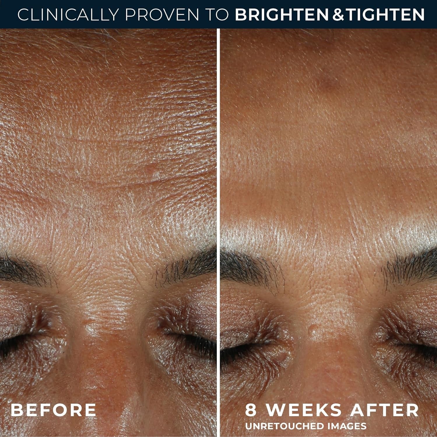 RoC Revive + Glow Vitamin C Brightening Serum – Anti-Aging Daily Treatment