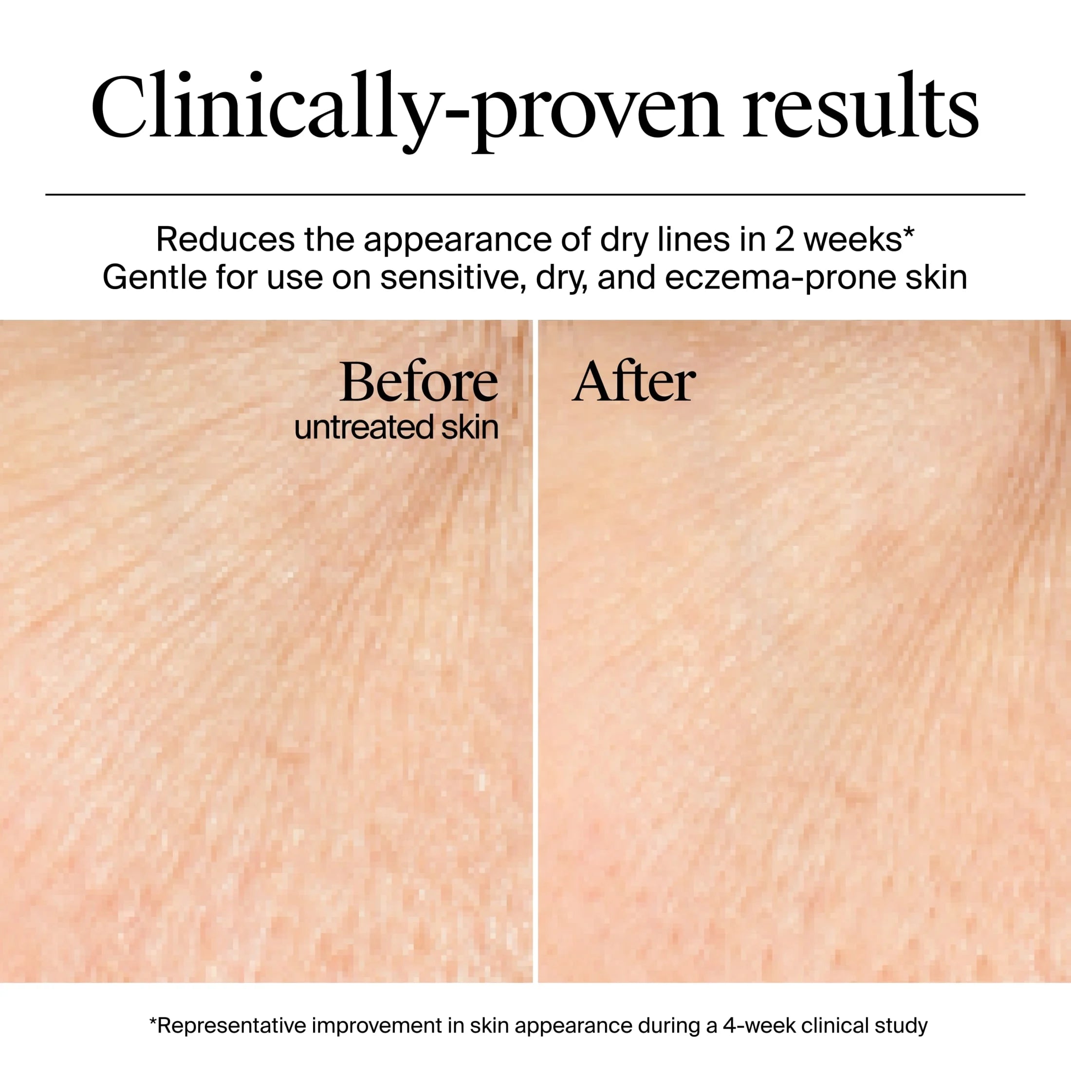 Hydro Boost Hyaluronic Acid Gel Cream, 1.7 Fl. Oz