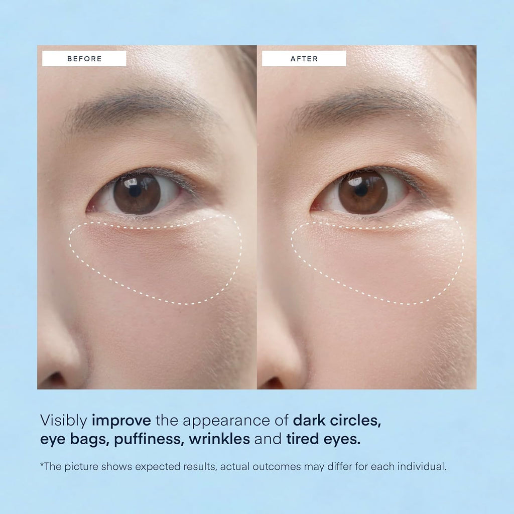 Terez & Honor Korean Hydrogel Eye Patches – Dark Circle & Puffiness Repair (60 Count)