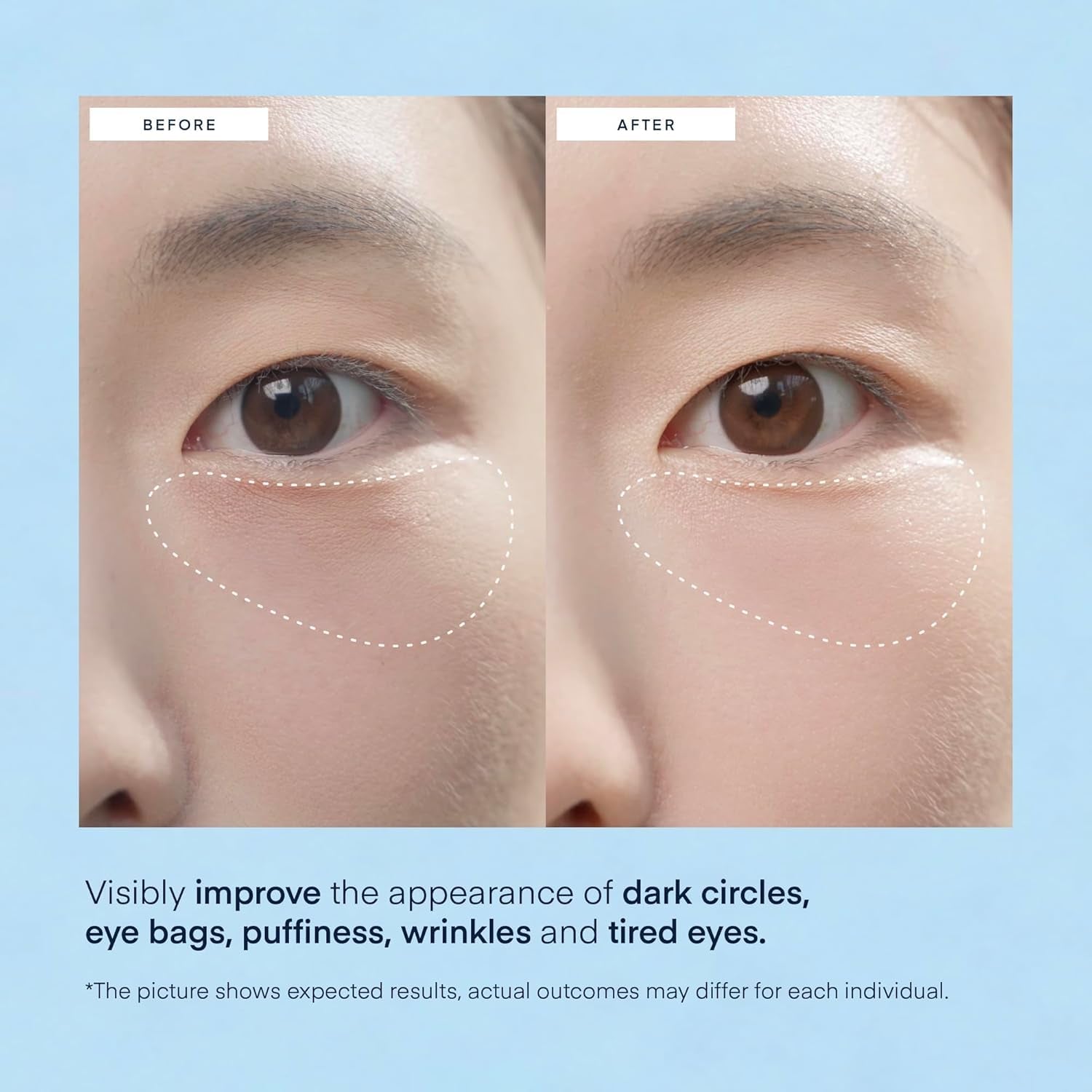 Terez & Honor Korean Hydrogel Eye Patches – Dark Circle & Puffiness Repair (60 Count)