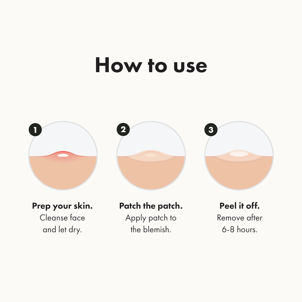 Original Patch from  – the #1 Hydrocolloid Acne Pimple Patch for Shrinking Zits and Whiteheads in 1 Use; Nighttime Spot Stickers for Face and Skin (72 Count)