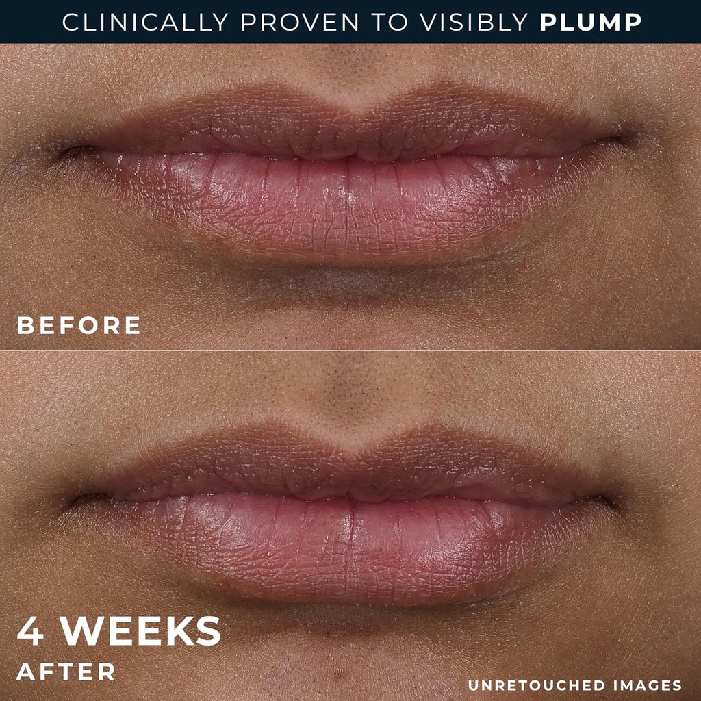 RoC Peptide Plump Lip Treatment + Eye Smooth Bonus