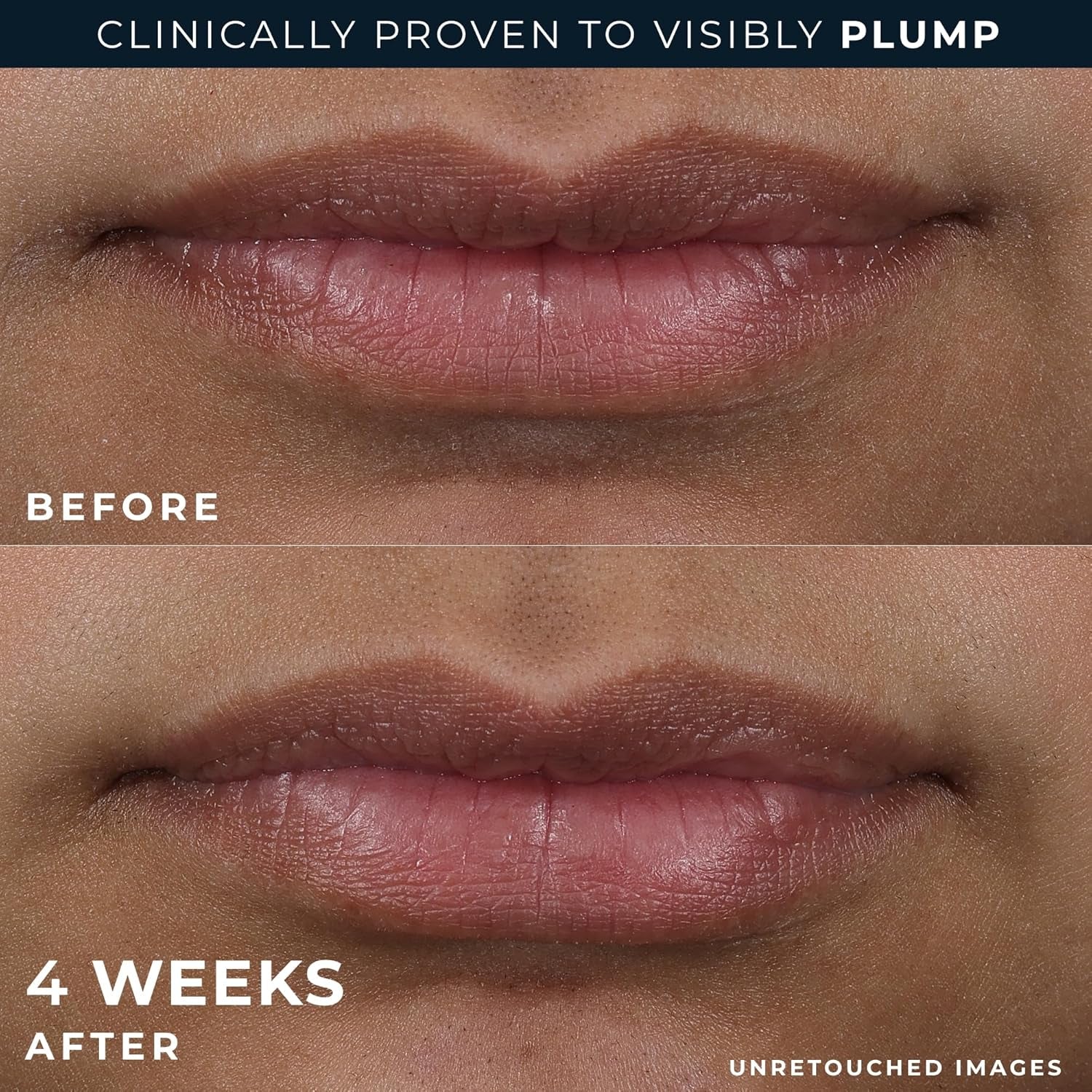 RoC Peptide Plump Lip Treatment + Eye Smooth Bonus