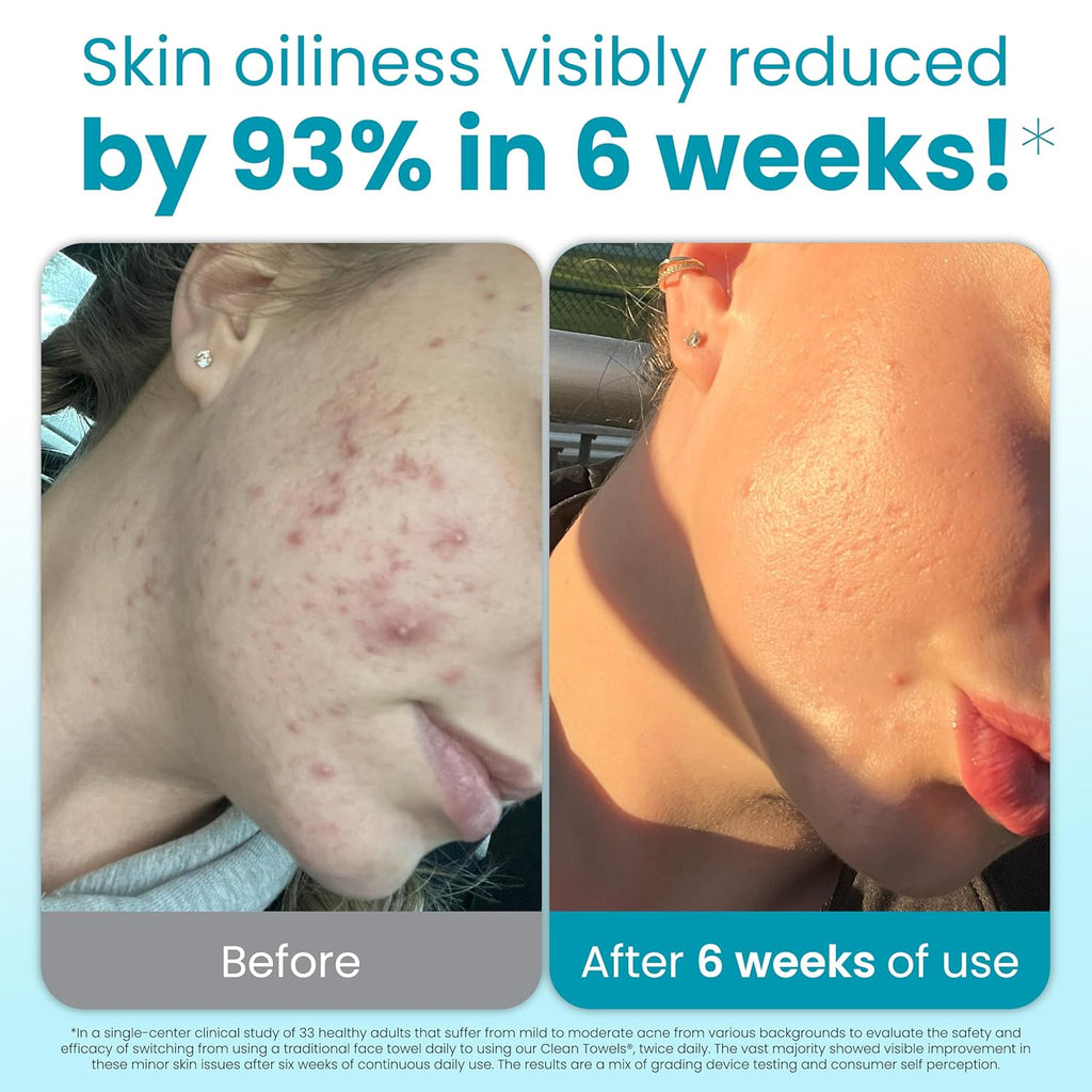 Clean Skin Club Blemish Control Face Towels XL – Disposable Exfoliating Towels for Oily & Acne-Prone Skin