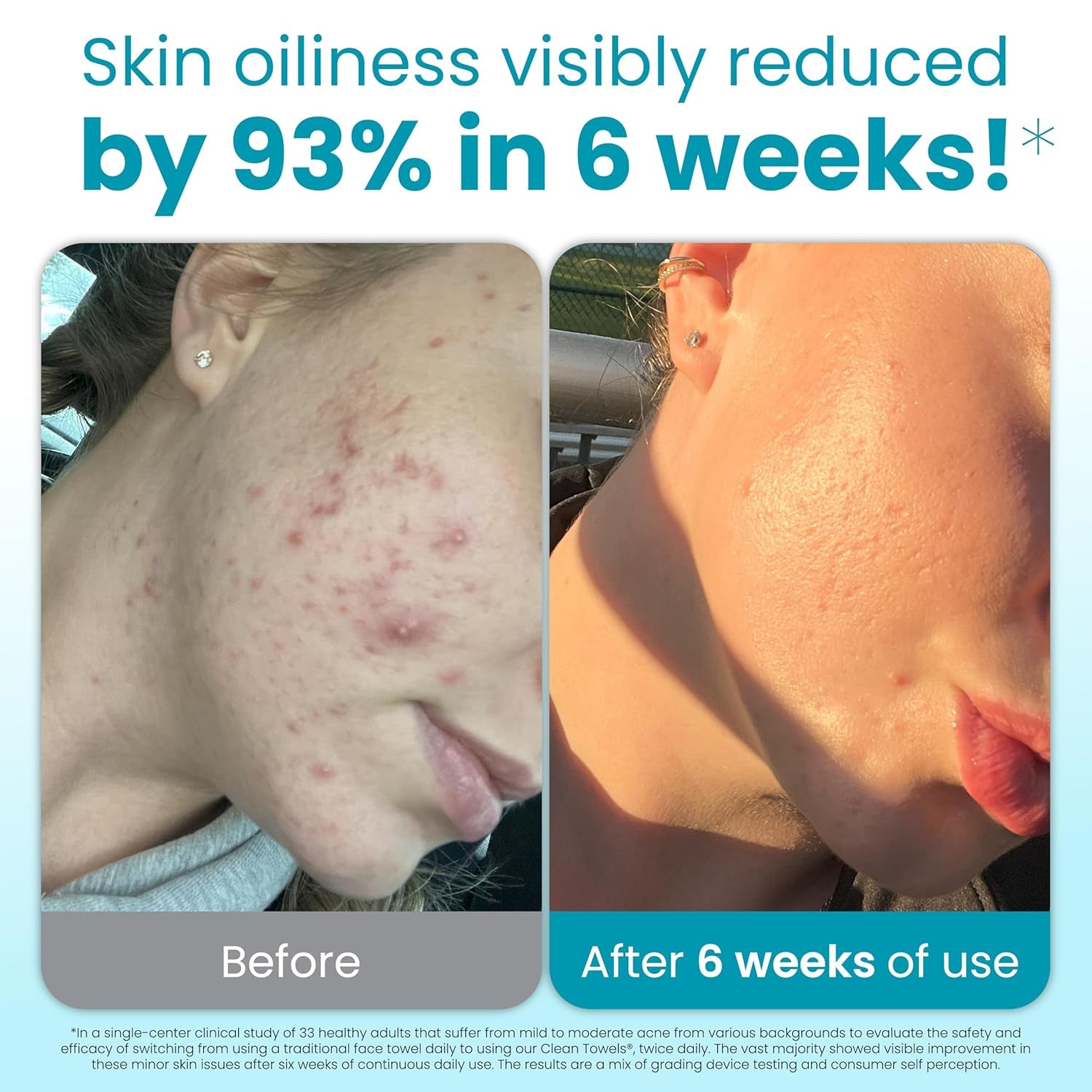 Clean Skin Club Blemish Control Face Towels XL – Disposable Exfoliating Towels for Oily & Acne-Prone Skin