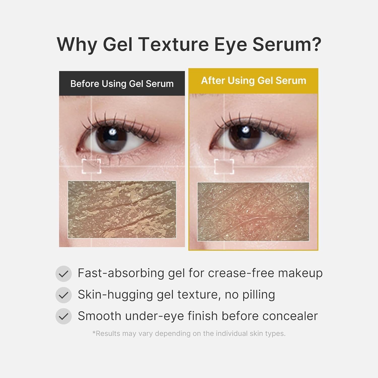 Medicube Kojic Acid Turmeric Eye Serum – Brightening & Depuffing Eye Gel with Vitamin C + Caffeine