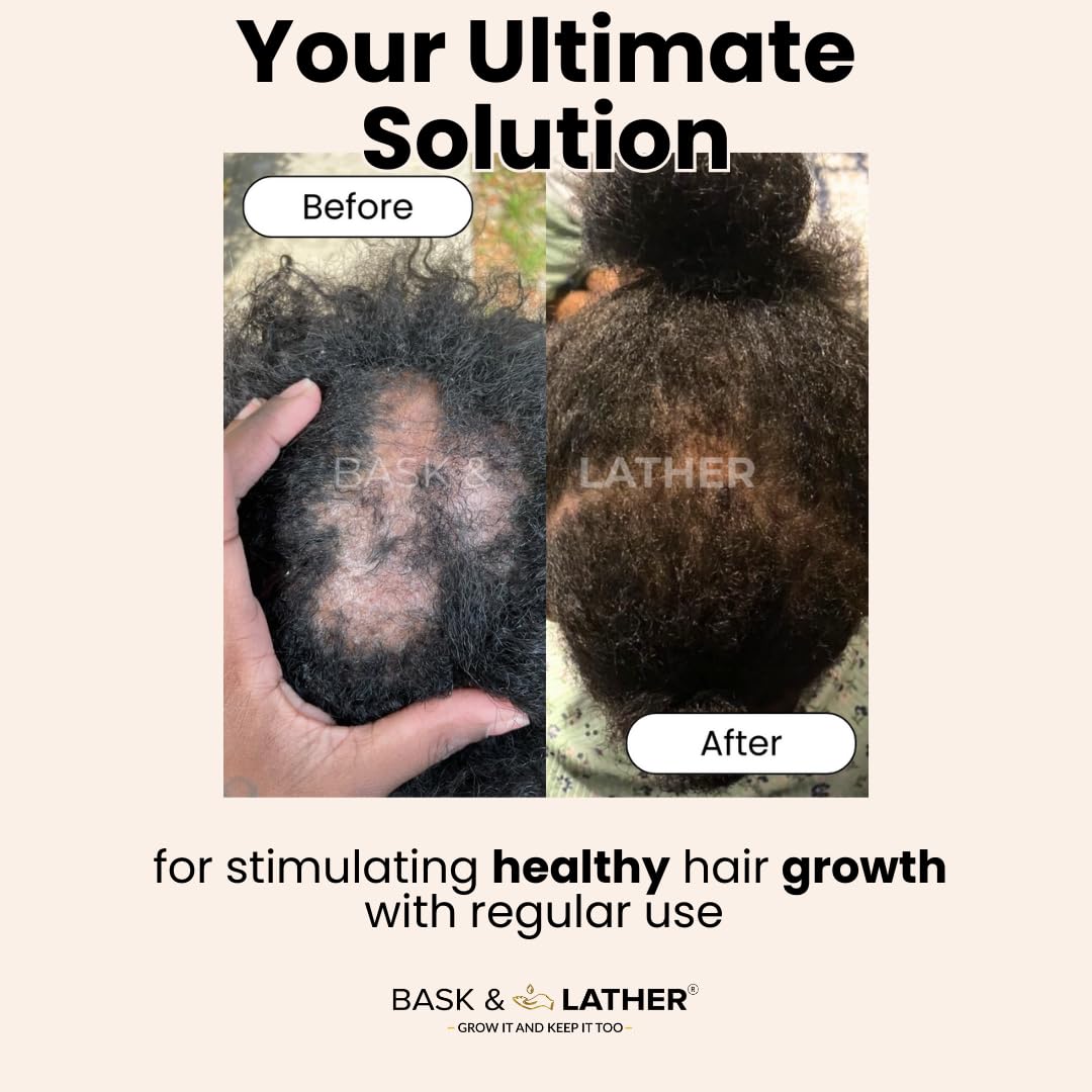 Revitalize Your Hair with Our Cold Pressed Mint & Rosemary Scalp Stimulator Oil - Organic Growth Solution for All Hair Types, 2 Fl Oz