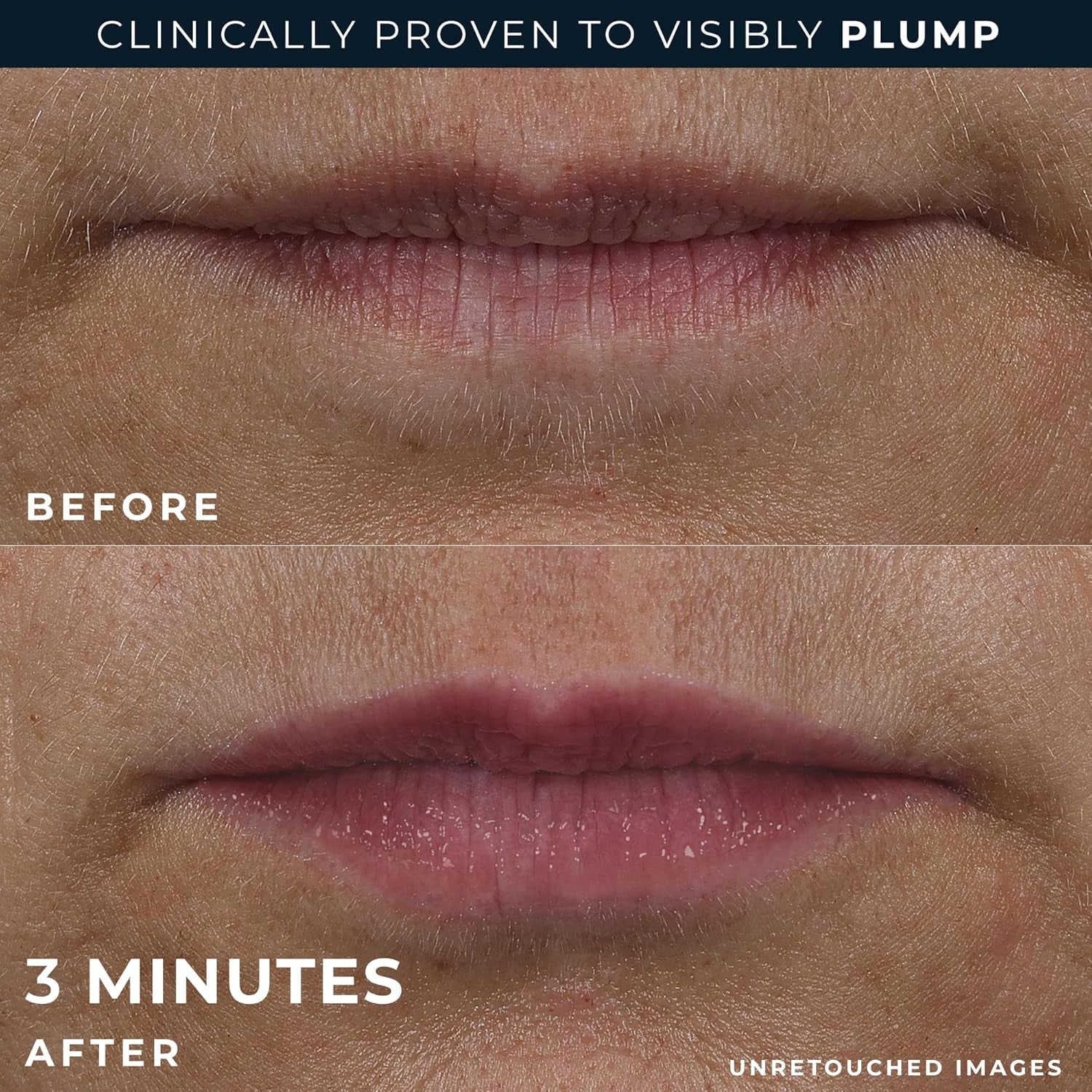 RoC Peptide Plump Lip Treatment + Eye Smooth Bonus