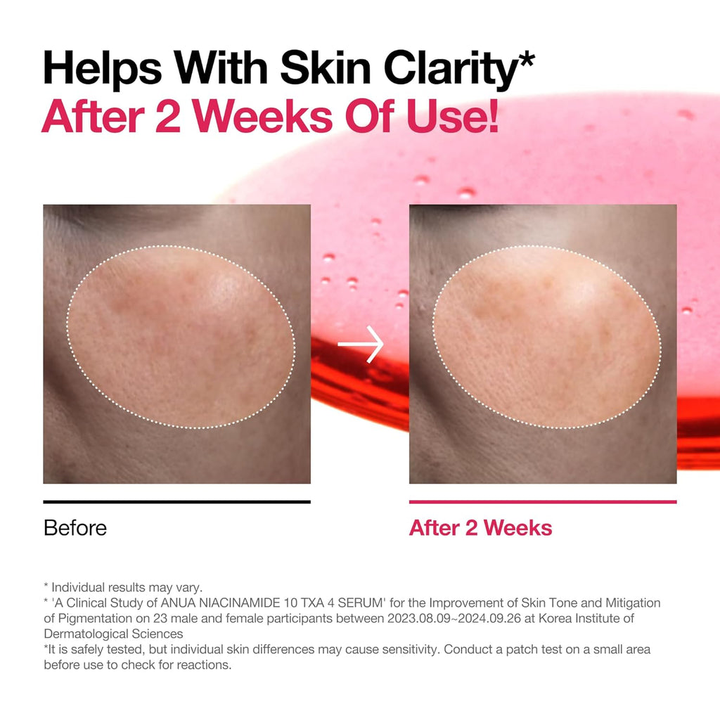 ANUA Glow Boost Niacinamide + TXA Serum – Dark Spot & Radiance Repair