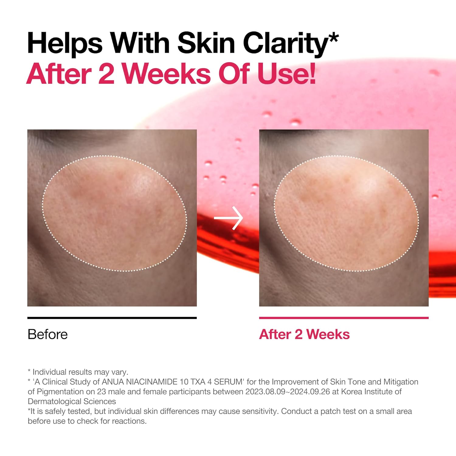 ANUA Glow Boost Niacinamide + TXA Serum – Dark Spot & Radiance Repair
