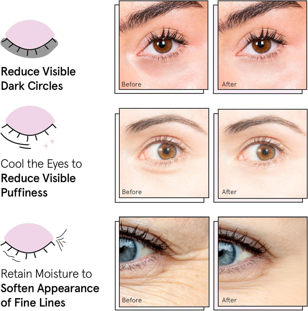 Grace & Stella Gold Under Eye Masks – Dark Circle & Puffiness Repair (24 Pairs)