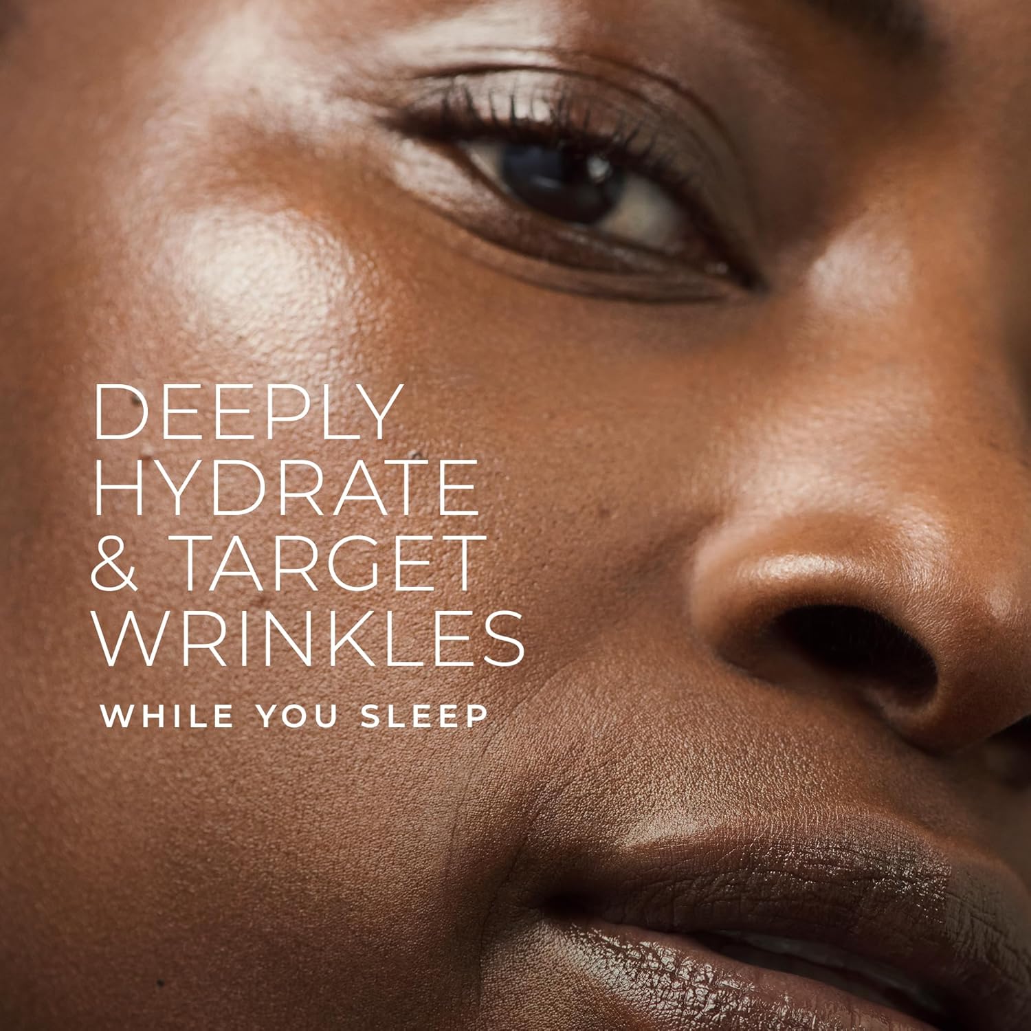 RoC Retinol Renewal Night Cream – Deep Wrinkle Repair & Firming Moisturizer