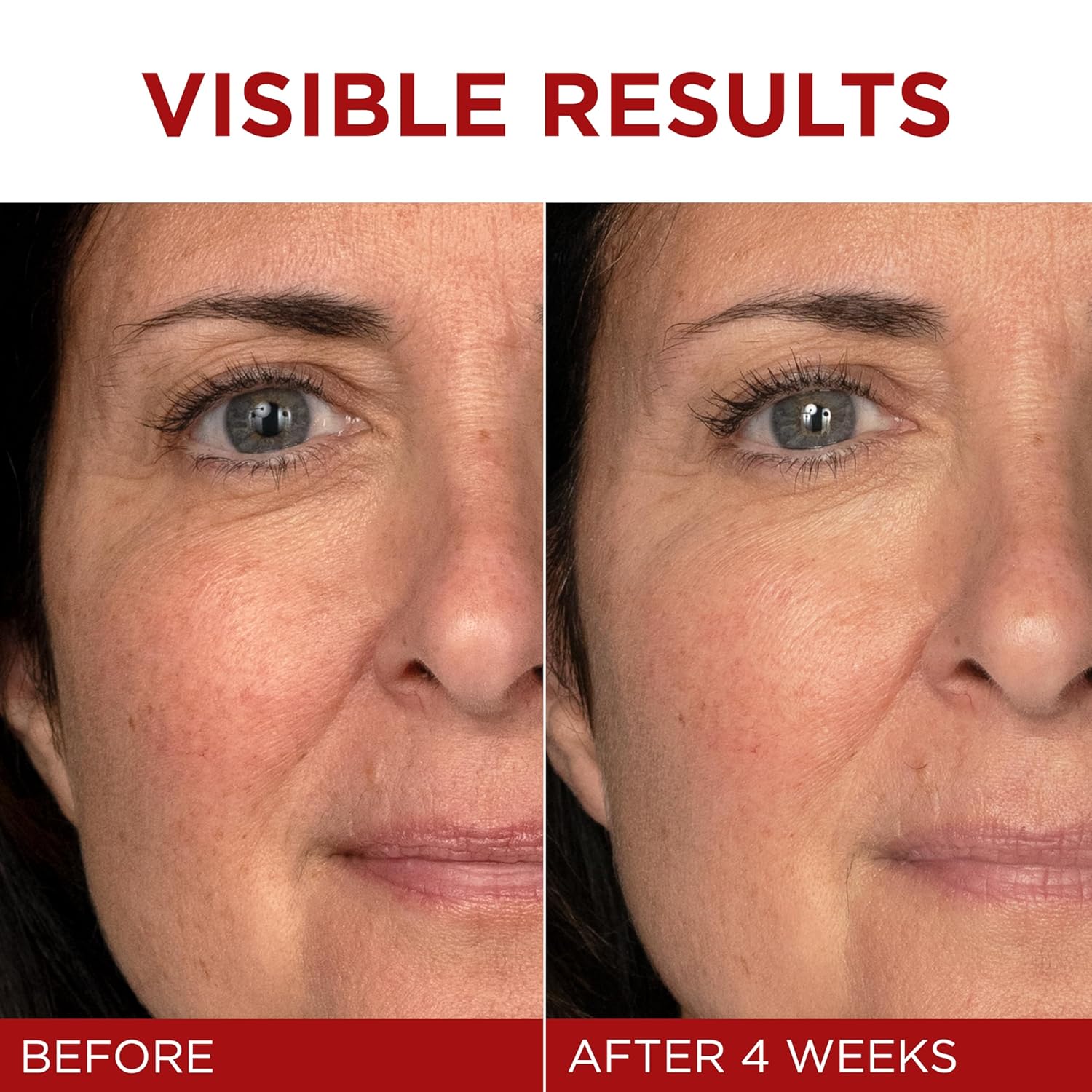 L’Oréal Revitalift Triple Power Renewal Cream – Retinol + Vitamin C Moisturizer