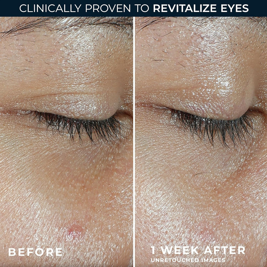 RoC Revive + Glow Vitamin C Eye Balm – Brightening & Firming Eye Care Duo