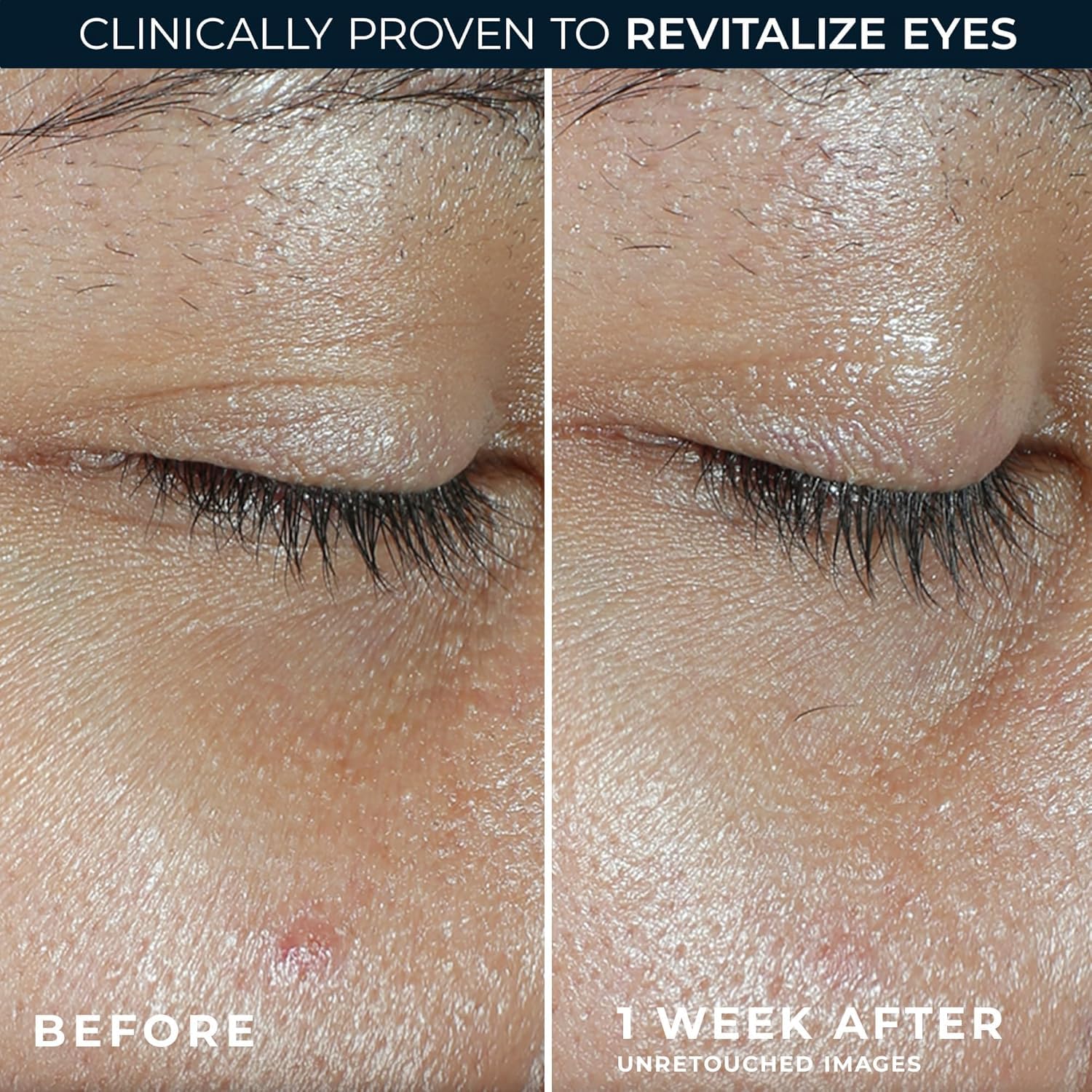 RoC Revive + Glow Vitamin C Eye Balm – Brightening & Firming Eye Care Duo