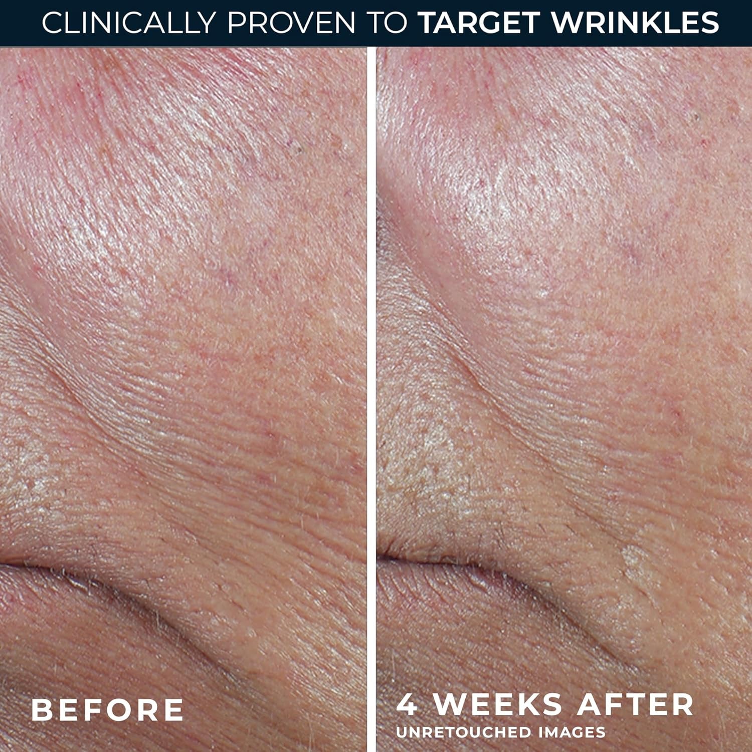 Derm Correxion Retinol Firming Serum Stick with Antioxidants to Visibly Tighten and Firm Wrinkles and Laugh Lines 1.0 Oz plus Retinol Eye Cream Packette