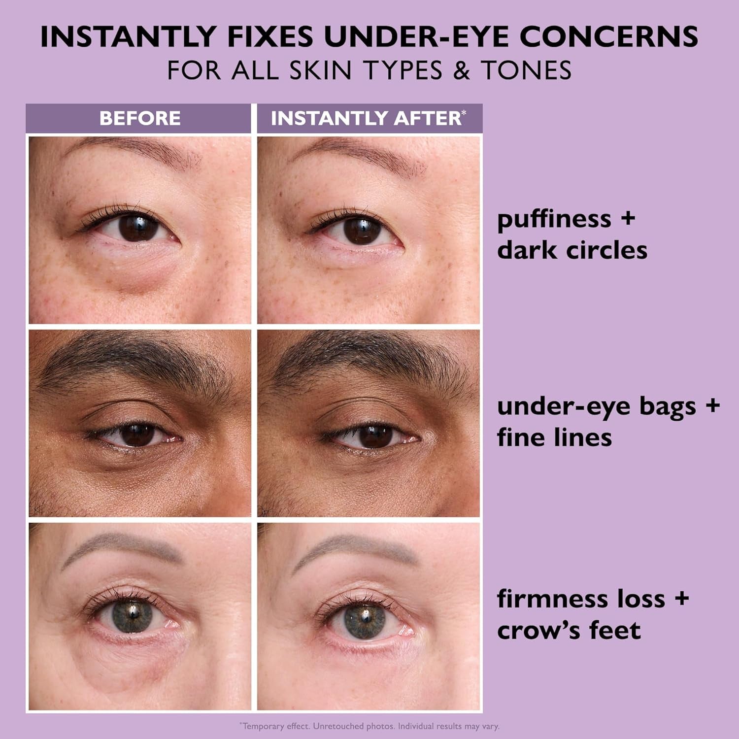 Peter Thomas Roth Instant FIRMx® Eye Tightener – Temporary Under-Eye Lift & Wrinkle Smoother