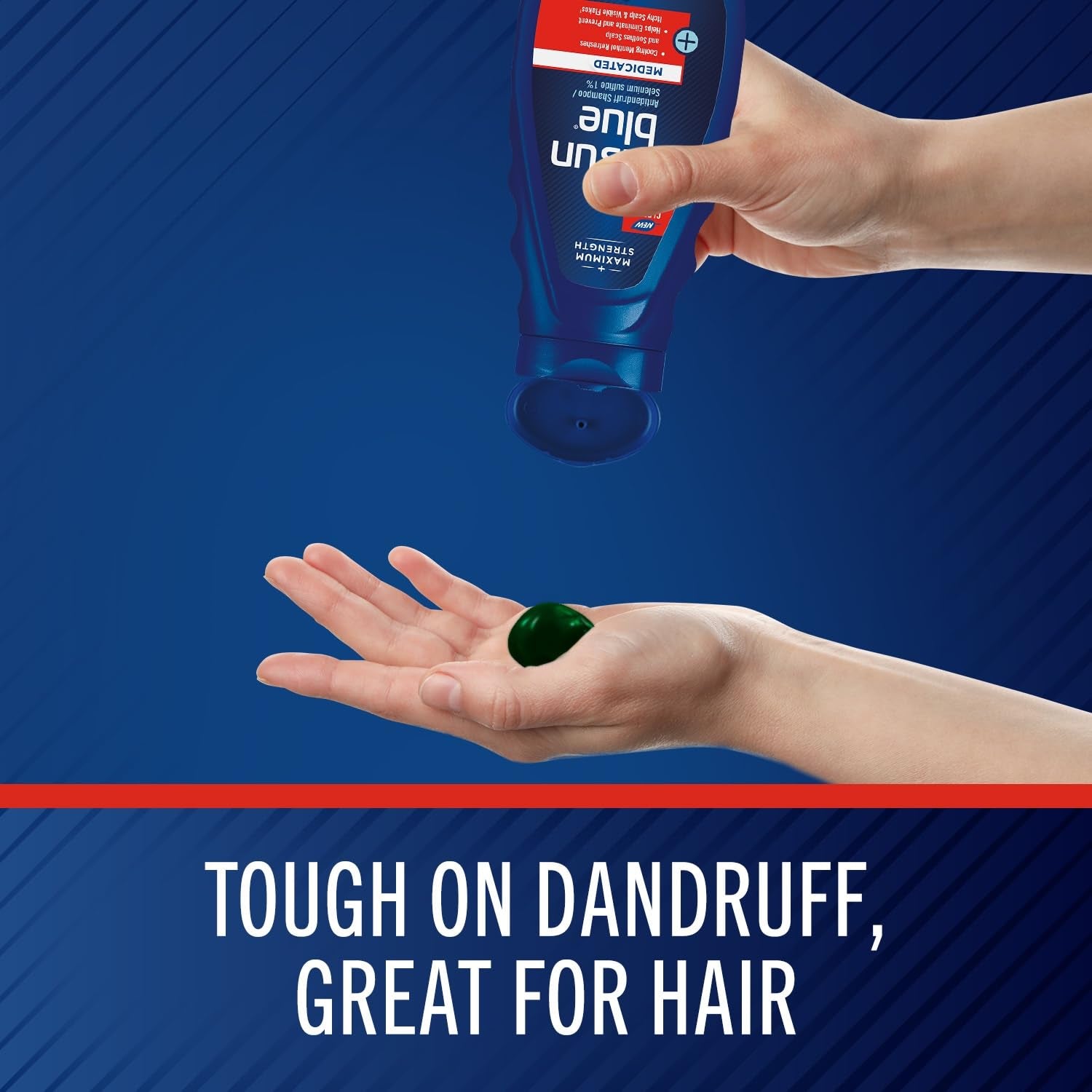 Selsun Blue Maximum Strength Medicated Shampoo – Instant Scalp Relief & Flake Control