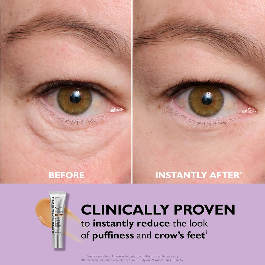 Peter Thomas Roth Instant FIRMx® Eye Tightener – Temporary Under-Eye Lift & Wrinkle Smoother