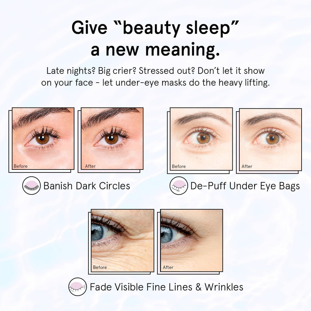 Grace & Stella Retinol Under Eye Patches – Dark Circle & Puffiness Repair (24 Pairs)