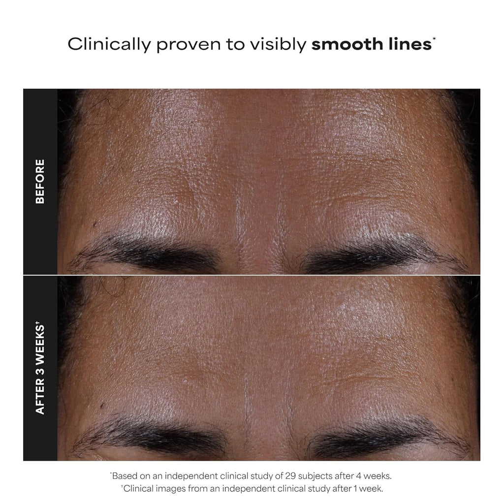 Paula’s Choice 2% BHA Liquid Exfoliant – Salicylic Acid Pore Minimizing Toner for Clear, Smooth Skin