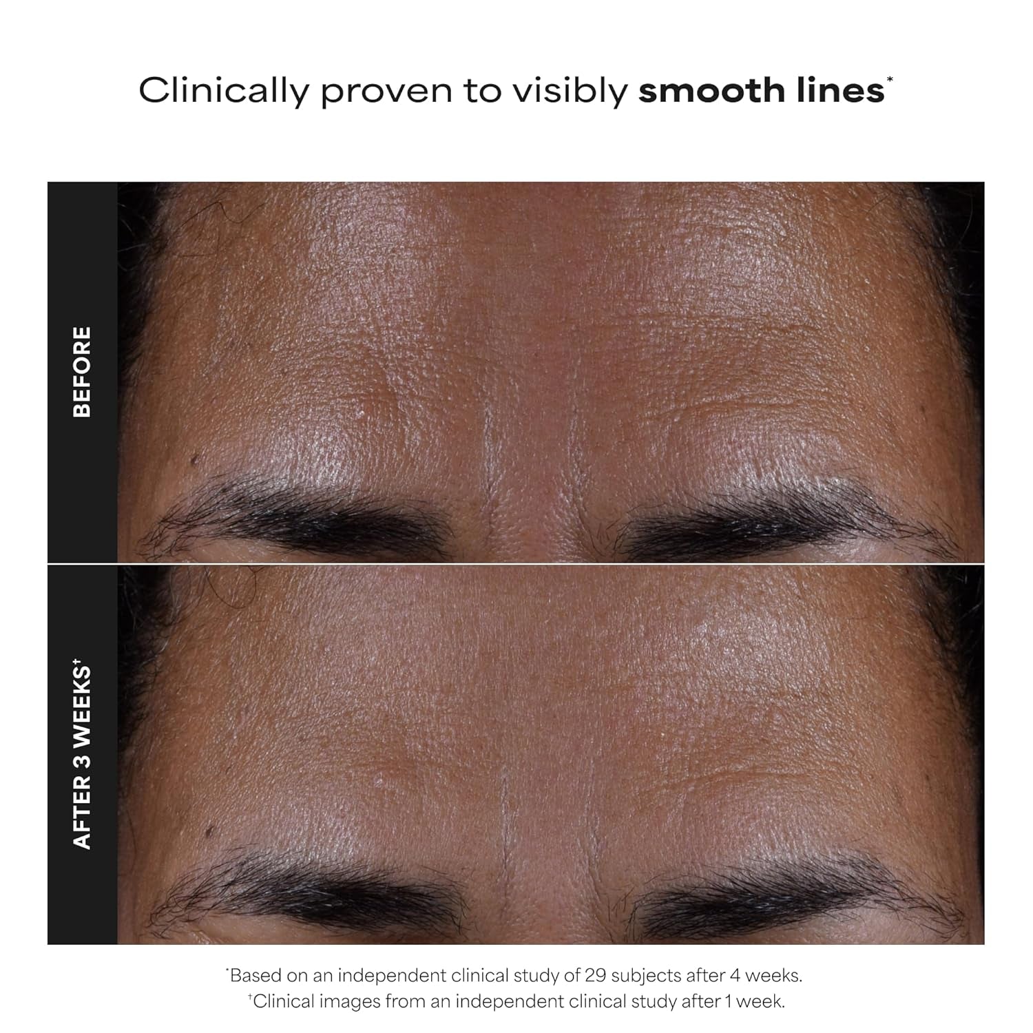 Paula’s Choice 2% BHA Liquid Exfoliant – Salicylic Acid Pore Minimizing Toner for Clear, Smooth Skin
